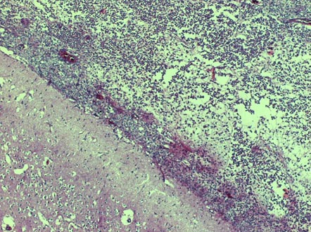 Figura 10: Vista panormica del encfalo que muestra abundante exudado purulento en el espacio subaracnoideo. H/E X5